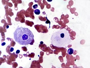 Resveratrol - clinical image