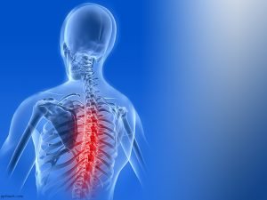A Stiff Back - clinical image 2 of 2
