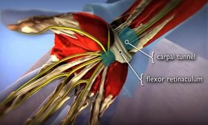 Carpal Tunnel Exercises - exercise sheet 2 of 2